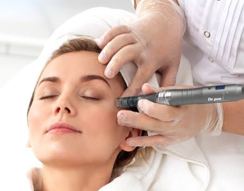 microneedling treatments in Lake Mary